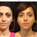 하나로신경과의원 | 광교 레디어스 어느 병원을 선택해야 하는지 의사 의견