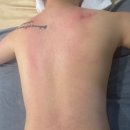 기장 정관 어깨통증 올바른 뷰티연구소 목,어깨(승모근),등,허리 후기