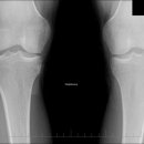 오금한의원 이미지