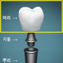 퍼즐치과기공소 이미지