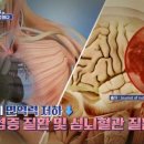 암 예방을 위한 면역력, 그 비밀을 파헤쳐라! 이미지