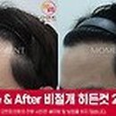 모먼트의원 이미지