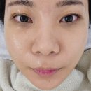 군산 피부샵 :: 레이드스킨