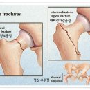 팟티팟티