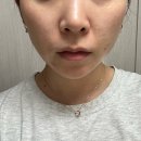 [홈모드 10주차] 홈모드 써마리프트 내돈내산 후기 / 3개월 사용 전후차이 비교