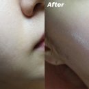 H1526 이미지