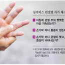 민도준류우마내과의원 네이버블로그