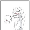 【수태음폐경(手太陰肺經)】 〔수태음폐경 (LU) ＞ LU11 소상 (少商)〕 이미지