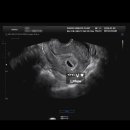 이정례의원 이미지