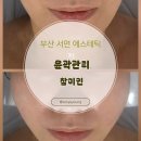 참미인 | 부산얼굴경락 잘하는 서면윤곽관리 ㅣ 참미인 후기