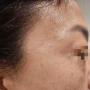 너반뷰티에스테틱 네이버블로그