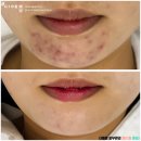 더 예쁨뷰티 이미지