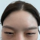 [당진] 이번에 새로오픈한 당진 성형외과 밴스의원 다녀왔습니다 !