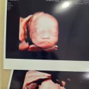 내손안의 건강 수지침 교실 | [임신일기#8] 25~28주: 임신중후기 증상, 산모교실, 베이비페어, 28주 주수촬영, 건강식단, 초음파검사