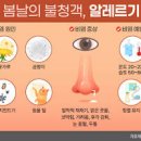 꽃가루 지수 알레르기 반응 검사 피부알레르기 증상 이미지