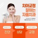 수원-1077 | 수원투명교정잘하는곳 찾는다면? 직접 가본 후기 공개