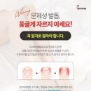 레푸스 이미지