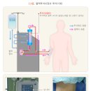 혈액투석의 실제 이미지