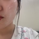 지에스25 동탄성심병원점 | 안면마비 입원 치료 후기 | 동탄 한림대병원 벨마비 치료 과정