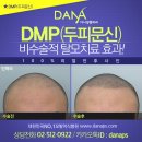 다나두피 이미지