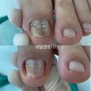네일앤풋닥터 이미지