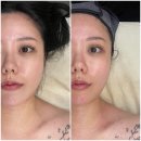 김진의디자인 | 대구 달서구피부관리 웨딩케어 전문 ❝진스케어❞ 재방문