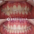 활짝웃는치과교정과치과의원 이미지