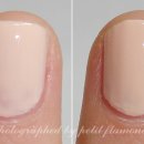 바른네일&스킨