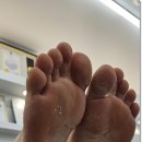 고양 화정 발각질 제거 대성공 풋네일&amp;문제성발톱 페디크루