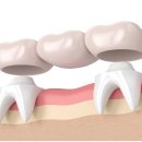 크라운치과보철과치과의원 이미지