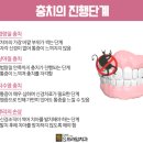 에스프라임 이미지