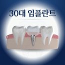 자연 | 30대임플란트 4개 6개 갯수 비용 자연스러움 후기