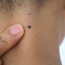 에스피부과의원 이미지