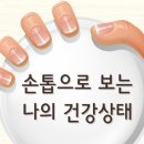 나의건강