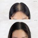 TMW 탈모왕수원 | 수원두피문신수강 잘 하는 곳, TMW 탈모왕 수원 아카데미