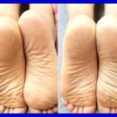 바른체형수기센터안마원 이미지