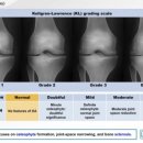 통증 잡는 마사지볼 이미지