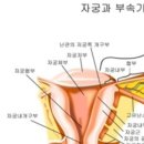 자궁경부 전기소작술 후기2 (+보험청구)