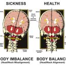 운동재활트레이닝 이미지
