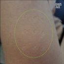 불주사 - 636 | 불주사
