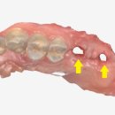 더바른치과기공소 이미지