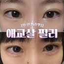 서초제일마디의원 | [신논현] 강남역 에버샘의원 "애교살 필러" 뉴라미스 리얼 후기 (가격, 통증, 유지 기간)