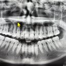 좋은이웃치과의원 이미지