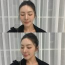 오사레 | 얼굴 주름 탄력 관리 창원 탐날에스테틱 미레브 VS 온다리프팅