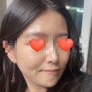 [대구 다이어트 관리] 산후 다이어트 및 관리 받고 온 후기(다이어트 수액, 온다 저렴이 피팅리프팅 관리)