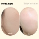 뷰티에잇 | 시흥 은계 피부관리 미백 탄력 주름 케어 모드에잇 후기