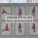 대구 서구 발각질 특허받은 각질 제거 방법 김혜진네일 앤 풋시스 본점
