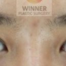 위너성형외과의원 이미지