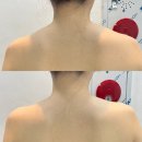 미인 | 청주웨딩관리 후광미인 만족 후기