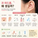 내 코를 찾아주세요 | 귀 여드름 원인 갑자기 코안 코밑 코에 뾰루지 얼굴 부위별 여드름 없애는법
